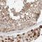 Mitochondrial RRNA Methyltransferase 3 antibody, NBP1-83843, Novus Biologicals, Immunohistochemistry paraffin image 