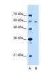 Centrosomal Protein 55 antibody, NBP1-53040, Novus Biologicals, Western Blot image 