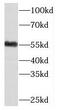 Meis Homeobox 2 antibody, FNab05110, FineTest, Western Blot image 