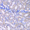 Regulator Of Microtubule Dynamics 3 antibody, LS-C335604, Lifespan Biosciences, Immunohistochemistry frozen image 