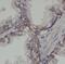 Phosphatidylinositol Glycan Anchor Biosynthesis Class B antibody, FNab06439, FineTest, Immunohistochemistry frozen image 