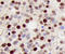 Cyclin Dependent Kinase Inhibitor 1B antibody, MAB22561, R&D Systems, Immunohistochemistry paraffin image 