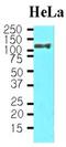 Heat Shock Protein Family H (Hsp110) Member 1 antibody, NBP1-04304, Novus Biologicals, Western Blot image 