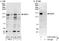 ATP Binding Cassette Subfamily B Member 1 antibody, A303-625A, Bethyl Labs, Western Blot image 