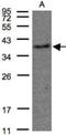 Thromboxane A2 Receptor antibody, NBP1-31106, Novus Biologicals, Western Blot image 