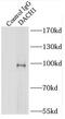 Dachshund homolog 1 antibody, FNab02230, FineTest, Immunoprecipitation image 