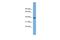 Pleckstrin Homology Domain Containing A1 antibody, A08988, Boster Biological Technology, Western Blot image 