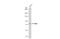 Protein Phosphatase, Mg2+/Mn2+ Dependent 1D antibody, GTX130700, GeneTex, Western Blot image 