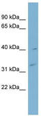 Myozenin 1 antibody, TA346637, Origene, Western Blot image 