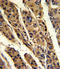 Fortilin antibody, LS-C160151, Lifespan Biosciences, Immunohistochemistry paraffin image 