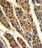 Tumor Protein, Translationally-Controlled 1 antibody, LS-C160151, Lifespan Biosciences, Immunohistochemistry paraffin image 