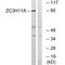 Zinc Finger CCCH-Type Containing 11A antibody, A10568, Boster Biological Technology, Western Blot image 