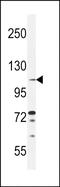 Tolloid Like 2 antibody, PA5-71516, Invitrogen Antibodies, Western Blot image 