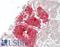 Ubiquitin C-Terminal Hydrolase L1 antibody, LS-B13568, Lifespan Biosciences, Immunohistochemistry paraffin image 