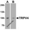Transient Receptor Potential Cation Channel Subfamily V Member 4 antibody, 7695, ProSci Inc, Western Blot image 