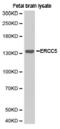 ERCC Excision Repair 5, Endonuclease antibody, LS-C192764, Lifespan Biosciences, Western Blot image 