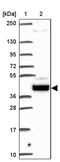 Sosondowah Ankyrin Repeat Domain Family Member D antibody, PA5-64253, Invitrogen Antibodies, Western Blot image 