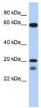 Myogenic factor 5 antibody, TA329267, Origene, Western Blot image 