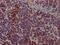 Janus Kinase 3 antibody, CSB-RA206737A0HU, Cusabio, Immunohistochemistry paraffin image 