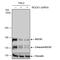 Rho Associated Coiled-Coil Containing Protein Kinase 1 antibody, NBP2-19297, Novus Biologicals, Western Blot image 