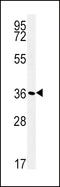 Sodium/potassium-transporting ATPase subunit beta-1 antibody, LS-C156644, Lifespan Biosciences, Western Blot image 