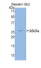 Folate Receptor Alpha antibody, abx102563, Abbexa, Enzyme Linked Immunosorbent Assay image 