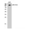 Protein Tyrosine Kinase 2 antibody, LS-C381357, Lifespan Biosciences, Western Blot image 