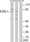 EPS8 Like 1 antibody, A30090, Boster Biological Technology, Western Blot image 