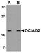 OCIA Domain Containing 2 antibody, A13969-1, Boster Biological Technology, Western Blot image 