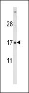 Follicle Stimulating Hormone Subunit Beta antibody, LS-C166259, Lifespan Biosciences, Western Blot image 