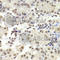 RuvB Like AAA ATPase 1 antibody, A5723, ABclonal Technology, Immunohistochemistry paraffin image 