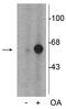 Tyrosine Hydroxylase antibody, P01917, Boster Biological Technology, Western Blot image 