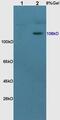 Nuclear Receptor Subfamily 3 Group C Member 2 antibody, GTX37373, GeneTex, Western Blot image 