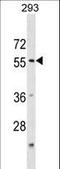 Katanin Catalytic Subunit A1 antibody, LS-C159964, Lifespan Biosciences, Western Blot image 