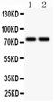 Bruton Tyrosine Kinase antibody, PB9134, Boster Biological Technology, Western Blot image 