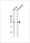 RAB27B, Member RAS Oncogene Family antibody, MA5-24743, Invitrogen Antibodies, Western Blot image 