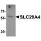 Solute Carrier Family 29 Member 4 antibody, TA349154, Origene, Western Blot image 
