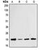 Cofilin 1 antibody, orb214132, Biorbyt, Western Blot image 