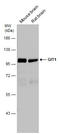GIT ArfGAP 1 antibody, GTX133292, GeneTex, Western Blot image 