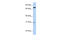 Mitogen-Activated Protein Kinase Kinase Kinase Kinase 1 antibody, 26-096, ProSci, Enzyme Linked Immunosorbent Assay image 