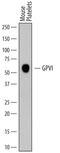 Glycoprotein VI Platelet antibody, AF6758, R&D Systems, Western Blot image 