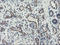 Diphthamide Biosynthesis 2 antibody, LS-C337761, Lifespan Biosciences, Immunohistochemistry paraffin image 