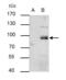 Phosphoinositide-3-Kinase Regulatory Subunit 1 antibody, GTX111068, GeneTex, Immunoprecipitation image 