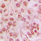 Galectin 3 antibody, LS-C352467, Lifespan Biosciences, Immunohistochemistry frozen image 