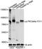 Protein Kinase C Delta antibody, AP0496, ABclonal Technology, Western Blot image 