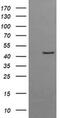Gamma-Butyrobetaine Hydroxylase 1 antibody, MA5-26199, Invitrogen Antibodies, Western Blot image 