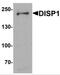 Dispatched RND Transporter Family Member 1 antibody, NBP2-81818, Novus Biologicals, Western Blot image 