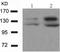Histone Deacetylase 4 antibody, TA322533, Origene, Western Blot image 