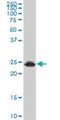 High Mobility Group Box 2 antibody, H00003148-M06, Novus Biologicals, Western Blot image 