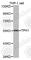 Tryptophan Hydroxylase 1 antibody, A1569, ABclonal Technology, Western Blot image 